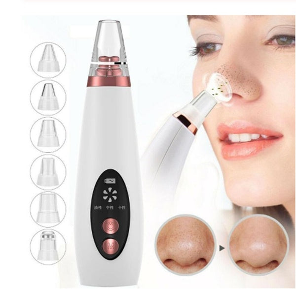 "Professional Pore Cleanser – Blackhead Suction & Deep Cleansing Device"